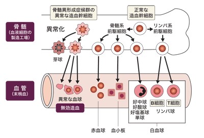 骨髄